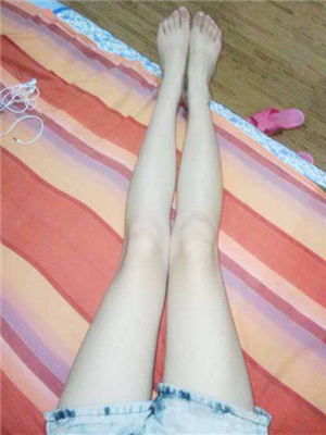 東方和諧王自謙醫生做的大腿抽脂，分享一下我的果吧~